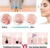 Blackhead Remover Rechargeable